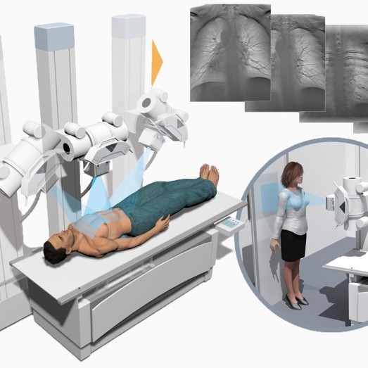 3D Digital X-Ray System (Tomosynthesis)