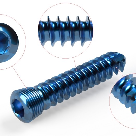 CANCELLOUS LOCKING SCREW