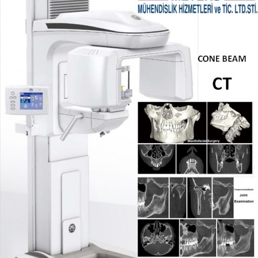 DENTOM CBCT