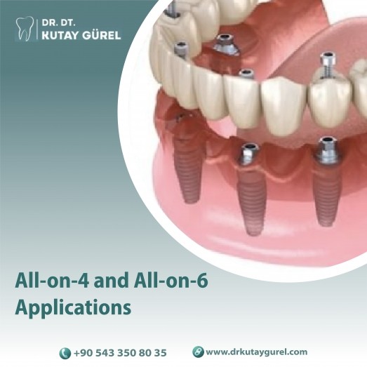 Implant Treatments