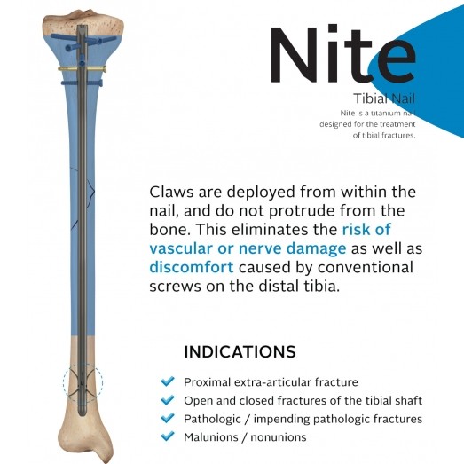 Nite Tibia Çivisi Pençeli